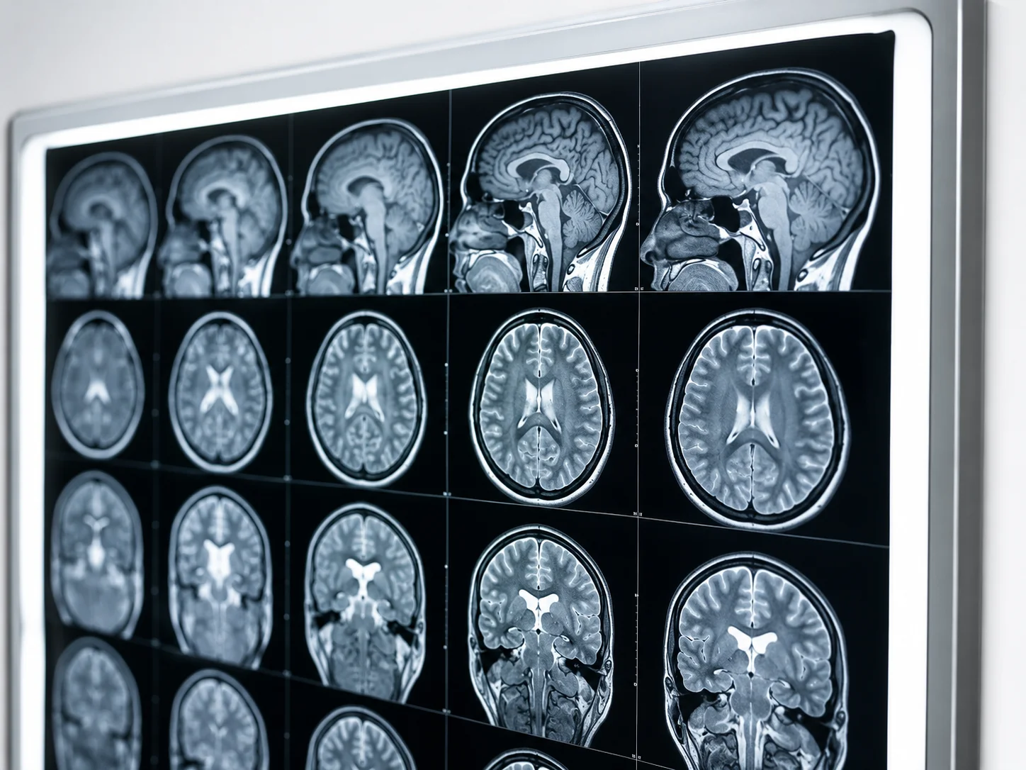 Brain MRI / Imaging
